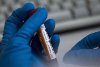 Международная федерация тяжелой атлетики временно отстранила из-за допинга 5 спортсменов из РФ